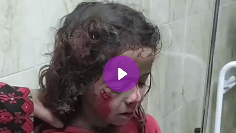 طفلة خرجت من تحت أنقاض منزلها الذي قصفه الاحتلال في غزة