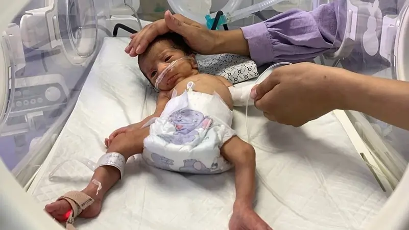 Catastrophic Infants in Gaza battle to stay alive amid formula shortage 2