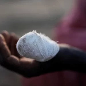 hand tawila sudan fasher reuters.jpg